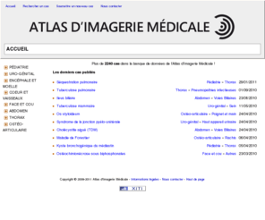 atlasimagerie.net: Atlas d'Imagerie Médicale - Cas cliniques de radiologie
L'Atlas d'Imagerie Médicale est la plus grande banque de données francophone collaborative, illustrée, et libre de consultation de cas cliniques de radiologie