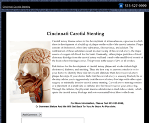 cincinnaticarotidstenting.com: Cincinnati Carotid Stenting For Artery Blockage
In Cincinnati, carotid artery stenting is used to open up the carotid artery if it becomes clogged with plaque.