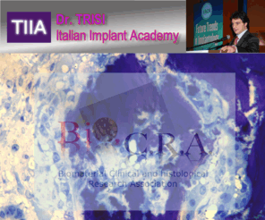 trisiacademy.com: Welcome
trisi, corso, corsi, implantologia, impianti, osso, biomateriali, chirurgia, rigenerazione, innesti, rialzi, seno, mascellare, mandibola, rigenerativa