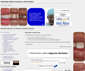 ortodoncia.biz: Ortodoncia en Madrid | Marta Pérez Torices
Información sobre los tratamientos más frecuentes en ortodoncia.