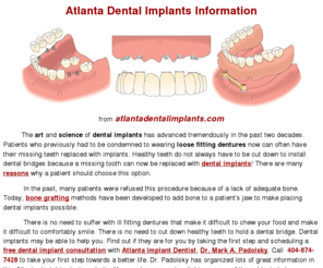 atlanta-implants.com: Atlanta Dental Implants - Atlanta Tooth Implants
Atlanta Dental Implants