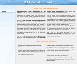 operation.net: Operation.net
alles was sie über Operationen wissen sollten 