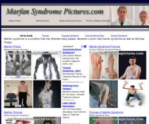 marfansyndromepictures.com: Marfan Syndrome Pictures | Photos of Marfan Syndrome Collection
Information and Pictures pertaining to Marfan Syndrome.
