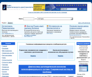 zhuravlev.info: Сайт практического рентгенолога - Рентгенология, рентген, лучевая диагностика
 Сайт практического рентгенолога: Статьи и программы по рентгенологии, радиологии и лучевой диагностике. Справочник эпонимических симптомов и синдромов в рентгенологии. Форум лучевых диагностов.