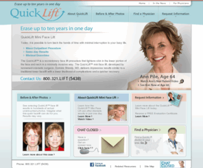 quickliftmd.com: QuickLift Mini Face Lift Surgery Procedure: Minimally Invasive Facial Plastic Surgery
When comparing traditional face lift surgery options, the revolutionary minimally invasive QuickLift™ facial plastic surgery procedure is a more affordable option that results in a very natural youthful appearance.