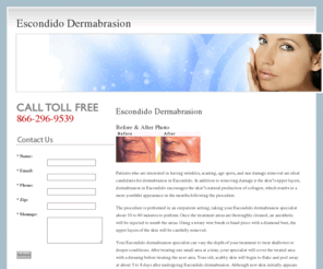 escondidodermabrasion.com: Escondido Dermabrasion
Locate a facility in the Esondido area specializing in dermabrasion treatment, view before and after photos of patients and learn about how dermabrasion is used for skin rejuvenation, scar removal and sun damage treatment.