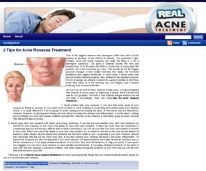 sanbac.com: How To Treat Acne - REAL ACNE TREATMENT
how to treat acne