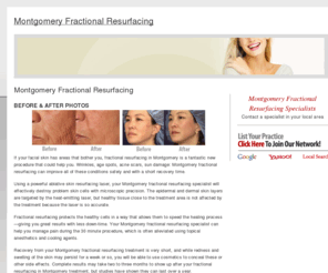 montgomeryfractionalresurfacing.com: Montgomery Fractional Resurfacing
Find a Montgomery Fractional Resurfacing specialist in your area. Learn about this nonsurgical skin rejuvenation procedure, view before and after photos of patients, and learn about the cost, benefits and results of a Fractional Resurfacing procedure.