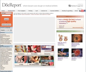 patientpromotion.com: Medical Illustrations, Medical Animations
The Doe Report is the Internet's largest library of medical demonstrative evidence for attorneys, containing thousands of medical exhibits, medical illustrations, medical animations, anatomical models, and medical research.