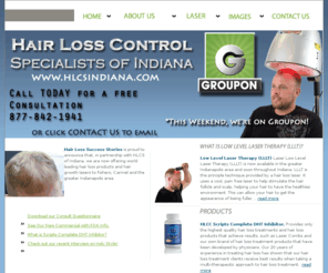 hlcsindiana.com: HLCSIndiana.com - Your hair loss soultion in Fishers, Carmel and the Greater Indianapolis area.
Hair Loss Control Specialists of Indiana, serving the hair loss of the greater Indianapolis area through Hair Loss Lasers and hair loss products.