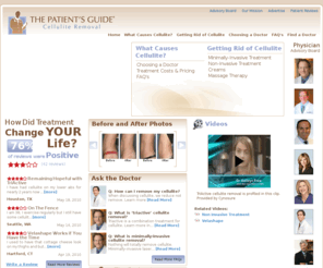 cellulite-removal.com: Cellulite Removal- Clinical information on the Condition
Cellulite Removal