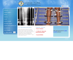 asamiturk.com: ASAMİ TÜRK - Ekstremite Rekonstrüksiyonu ve İlizarov Yöntemleri Uygulama
