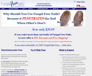 onychomycosiscure.com: Onychomycosis Cure for Toenail Fungus
Fungal Free Nails penetrates the nail when others don't.  The only doctor invented, scientifically proven topical product that treats onychomycosis. A cure for nail fungus.