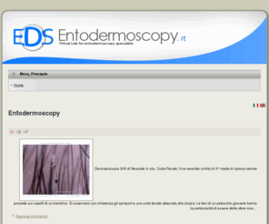 entodermoscopy.com: Entodermoscopy
Neologismo di recente (2006) introduzione in campo dermatologico derivante dalla fusione di due parole: Entomologia e Dermatoscopia.