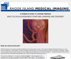 rifibroids.com: A WOMANS GUIDE TO UTERINE FIBROIDS
Description of new minimally invasive therapy for women with uterine
 fibroids that can be done without major surgery using catheter embolization of the uterine arteries.