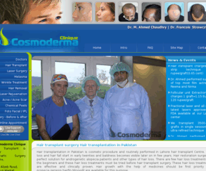 cosmoder.com: Hair Transplant Pakistan | Hair Transplantation in Pakistan Lahore | Hair Transplant Clinic, Cost
Hair Transplant in Pakistan and Laser Cosmetic and Plastic Surgery in lahore  by Dr.Ahmad Chaudhry MD Paris France contact +92-333-430-9999