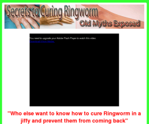 secretstocuringringworm.com: Secrets To Curing Ringworm
About this site 160 Characters 