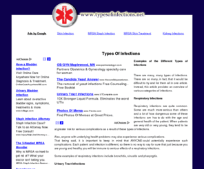 typesofinfections.net: Types Of Infections - Information on Infections
All about infections. Includes info on types of infections, infected lymph nodes, infected stitches, infection after surgery, gum infection treatment, fingernail infection, external yeast infection, chronic infection, antibiotics for sinus infection, uterus infection, sinus infection dizziness, recurring yeast infection, piercing infection, staph infection in nose, nose infections, muscle infection, mercer staph infection, mercer infection, gall bladder infection, and more.