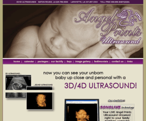 4dfacilities.com: 4D Ultrasound and 3D Ultrasound~- Sneak a peek of your baby - Baton Rouge 
and Lafayette, Louisiana
Angel Prints Ultrasound provides 3d Ultrasound and 4d Ultrasounds for expecting parents in Lafayette and Baton Rouge, LA and other surrounding areas in Louisiana.