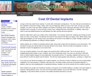 costsofdentalimplants.net: Curious About The Cost Of Dental Implants? Learn How Much You Should Be Payinf For Your Dental Implants.
Get average or estimated cost of dental implants anywhere in the US. Get the price of full or mini dental implants with or without insurance coverage. Learn how much you should be paying now.
