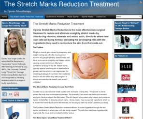 treatmentstretchmarks.com: The Stretch Marks Reduction Treatment by Eporex Mesotherapy
The Eporex Stretch Marks Reduction Treatment as seen on C4's Embarrassing Bodies