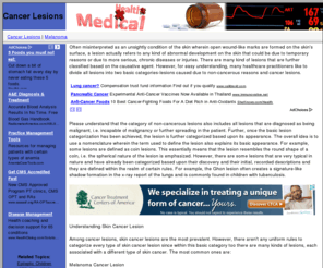 cancerlesions.com: Cancer Lesions -- symptoms of cancer
Learn to identify the signs of cancer development for prompt treatment.