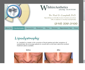 buffalo-hump.com: HIV Buffalo Hump Removal
Dr. Campbell is the leading expert in removing "Buffalo Hump" caused by HIV Lipodytrophy.  Dr. Campbell uses advanced liposuction techniques