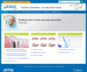 likenaturalteeth.nl: Astra Tech - Dentale implantaten von Astra Tech
Indien u kiest voor tandheelkundige implantaten van Astra Tech, bent u verzekerd van voorspelbare, betrouwbare en langdurige resultaten.