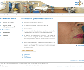 basocellulaire.com:  basocellulaire, baso-cellulaire, Centre des Cancers de la Peau, Paris, clinique Bizet, dermatologie
Le centre des cancers de la peau a pour vocation de prendre en charge le traitement des cancers de la peau, tumeurs, tumeur, tumeur cancéreuse, tumeurs cancéreuse, tumeur bénigne, tumeur maligne 