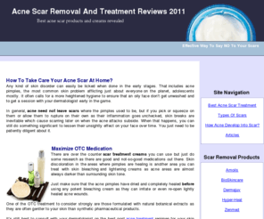 noacnescar.com: Acne Scar Cream Treatment And Solutions 2011
Discover how to remove, prevent and cure acne scars from face. The site designed to help our visitors choose the best scar treatment.