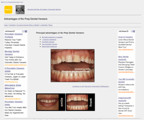 veneers.info: Advantages of No Prep Dental Veneers
Information and advantages of cosmetic veneers.