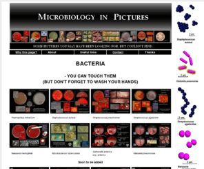 microbiologyinpictures.org: Microbiology pictures - photo gallery of bacteria. Microbiology in pictures.
Picture gallery of pathogenic and facultatively pathogenic bacterial species. Basic information about bacterial diseases, cultivation of bacteria, tests for identification and possible antibiotic treatmeant.