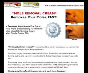 natural-mole-removal.com: Natural Mole Removal Cream! Mole Remover * Remove Moles In 3 
Days!
Natural Mole Removal Cream Proven To Remove Moles At Home In 3 Days. Has This Natural Mole Remover Made Surgery Obsolete?