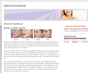 atlantaphotofacial.com: Atlanta Photofacial
Locate a Atlanta Photofacial specialist in your area. Learn about this skin rejuvenation procedure, view before and after photos of patients, learn about the cost, benefits and results of Photofacial.