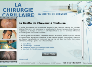 chirurgie-capillaire.com: Greffe de cheveux à Toulouse, Midi-pyrénées. Chirurgie capillaire, chute des cheveux. - LA CHIRURGIE CAPILLAIRE
Notre clinique de chirurgie capillaire offre les différents services : greffe capillaire, traitement contre la calvitie et la chute des cheveux, transplantation capillaire.