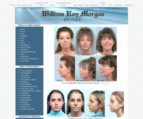 wrmorganmd.com: Cosmetic Surgery by William Roy Morgan MD FACS
See what can be done with cosmetic surgery. View before and after photographs and read patients' comments about their experience.