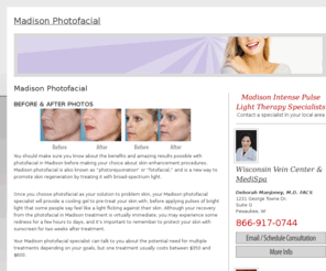 madisonphotofacial.com: Madison Photofacial
Locate a Madison Photofacial specialist in your area. Learn about this skin rejuvenation procedure, view before and after photos of patients, learn about the cost, benefits and results of Photofacial.