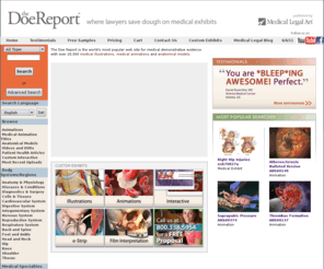 biotechpatentplaintiff.com: Medical Illustrations, Medical Animations
The Doe Report is the Internet's largest library of medical demonstrative evidence for attorneys, containing thousands of medical exhibits, medical illustrations, medical animations, anatomical models, and medical research.