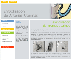 miomacentro.com: MIOMA CENTRO  //  Embolización de Arterias Uterinas
los miomas son tumores benignos frencuentes del aparato genital femenino. la embolizacion es un procedimiento seguro y eficiente para el tratamiento de sintomas producidos por los miomas