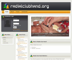 radialclubhand.org: Radial Club Hand.org
Radial Club Hand Information and Support Group with Forum for Radial Club Hand Issues.