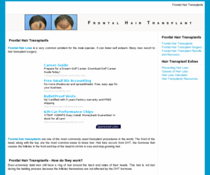 frontal-hair-transplants.com: Frontal Hair Transplants
What you should know about Frontal Hair Transplants.