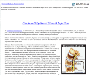 cincinnatiepiduralsteroidinjection.com: Cincinnati Epidural Steroid Injection For Back and Leg Pain
An epidural steroid injection is a shot of steroids to the epidural region of the spine to help relieve back and leg pain.  This procedure can be performed in Cincinnati.