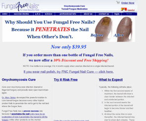 cureonychomycosis.com: Onychomycosis Cure for Toenail Fungus
Fungal Free Nails penetrates the nail when others don't.  The only doctor invented, scientifically proven topical product that treats onychomycosis. A cure for nail fungus.