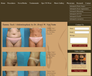 indytummy.com: Indianapolis Plastic Surgery | Meridian Plastic Surgeons
Meridian Plastic Surgeons is the premier plastic surgery office in the Indianapolis area, offering such services as breast augmentation, liposuction, and rhinoplasty