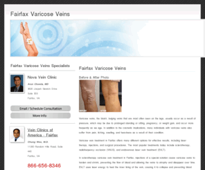 fairfaxvaricoseveins.net: Fairfax Varicose Veins
Fairfax varicose veins treatment specialists.