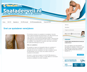 spatadervrij.nl: Spatadervrij.nl - Eenvoudig van uw spataderen af.
Spatadervrij.nl - de website van de nieuwe, zeer makkelijke en confortabele manier om uw spataderen te laten verwijderen.