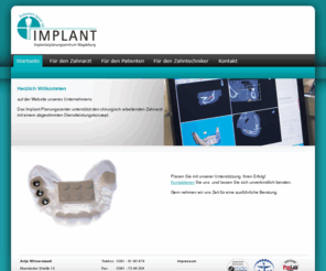 planungszentrum.info: IMPLANT-Planungscenter Magdeburg- Implantatplanungszentrum - Implantate - 3D-Planung
Das Implantatplanungszentrum IMPLANT aus Magdeburg bietet Implantate, 3D-Planung und Zahnimplantate zu genau kalkulierbaren Preisen an.