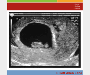 elliottlane.com: Elliott Allen Lane
The site of Elliott Allen Lane - pictures, videos, and more!