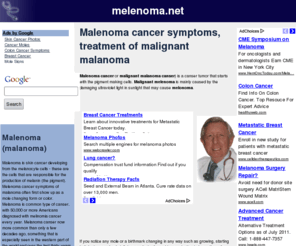 melenoma.net: Malenoma cancer symptoms, treatment of malignant malanoma
Malenoma cancer, or malignant malanoma, is a skin canser that has a good prognosis if you find it in time. Symptoms of melenoma are...