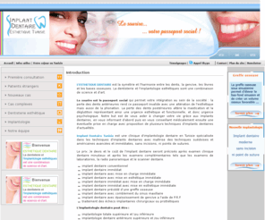 implantdentairetunisie.com: Implant Dentaire Tunisie : implantologie dentaire, dentisterie esthetique en Tunisie  
Implant Dentaire Tunisie est une clinique d'implantologie dentaire en Tunisie spécialisée dans les techniques d'implants dentaires avec maîtrise des techniques suédoises et américaines avancées et immédiates, sans incisions, ni points de sutures